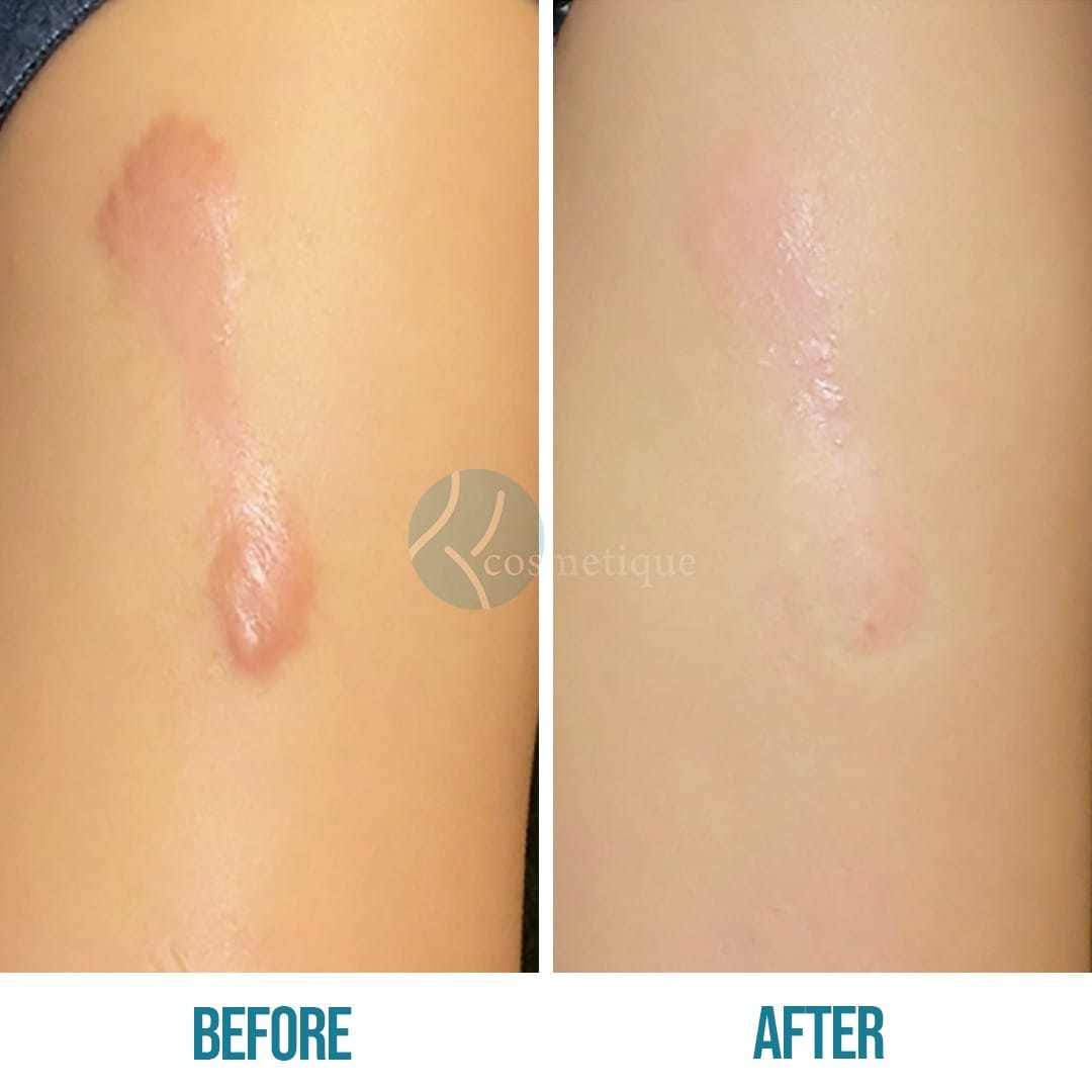 275589550_10166385288260441_2195860855149318370_n