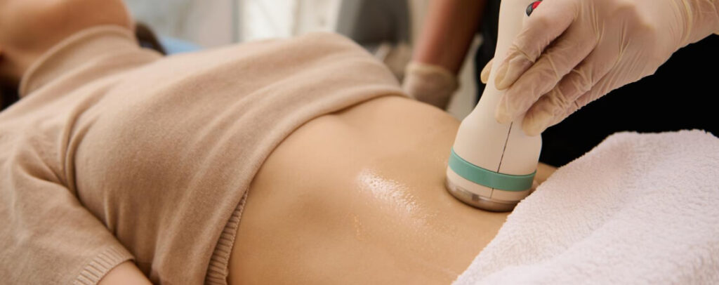 CoolSculpting treatment for targeted fat reduction and body contouring