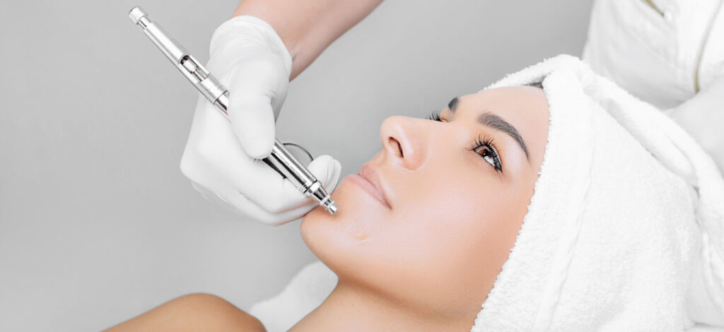 Chemical peel treatment for improving uneven skin tone, dark spots, and skin texture